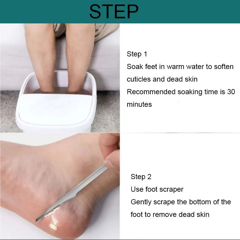 Kit pedicura para durezas y callos