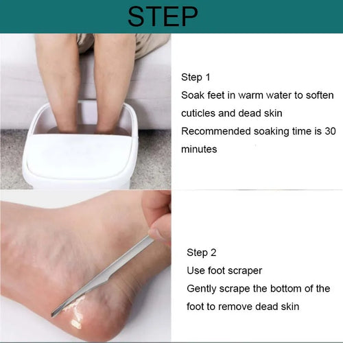 Kit pedicura para durezas y callos